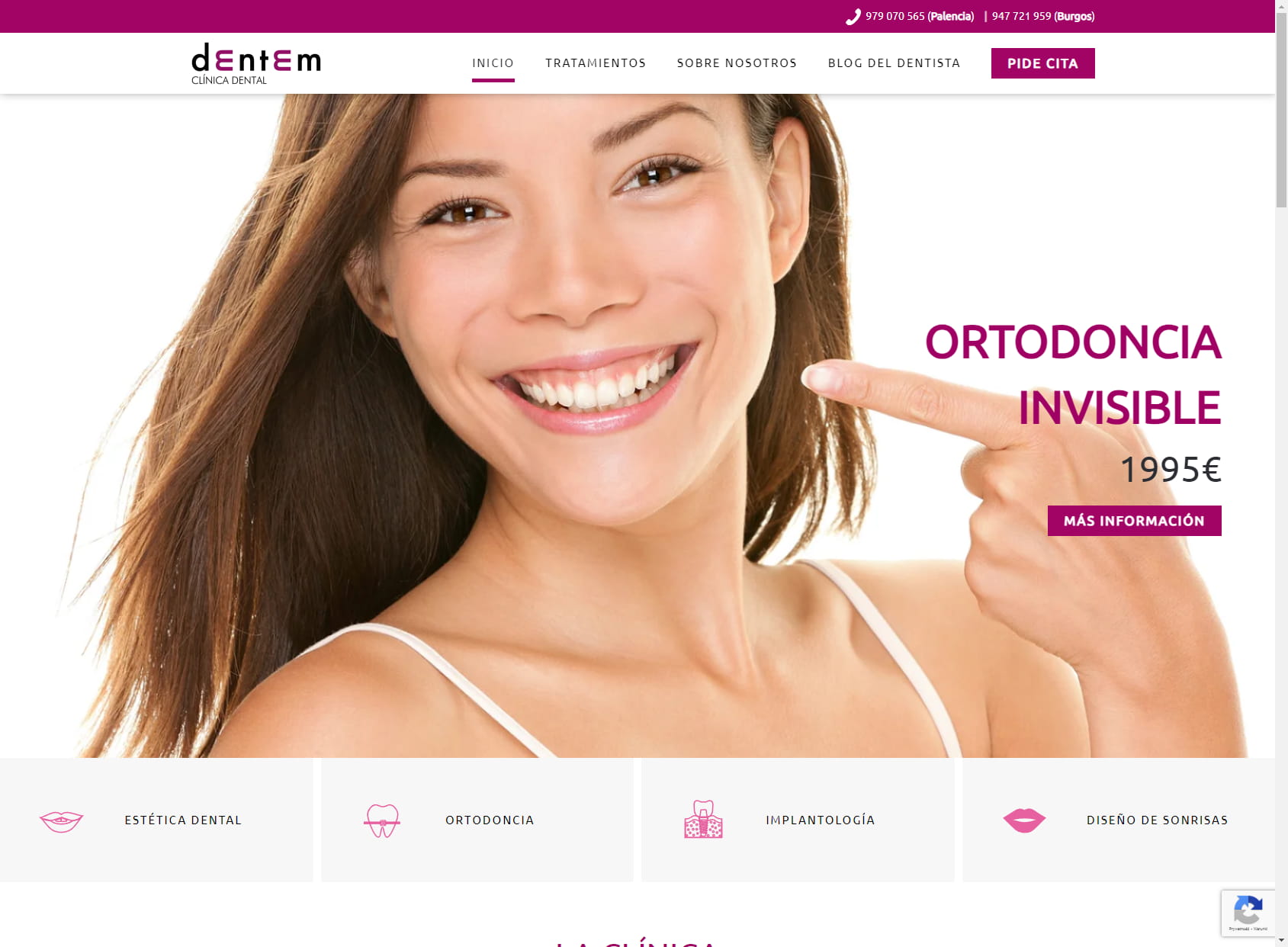 Dentem Ortodoncia Palencia Implantes